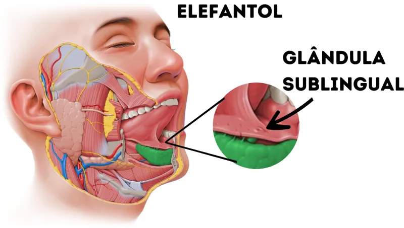 glandula-sublingual.webp
